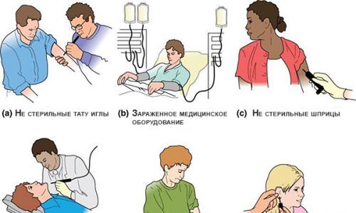 Вирусные гепатиты: симптомы, пути заражения, методы лечения